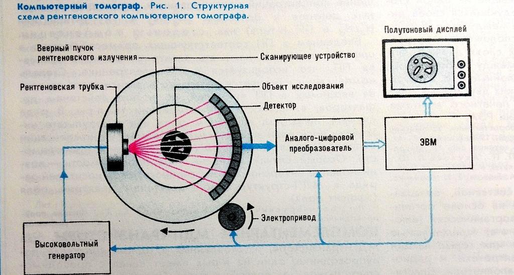 Мрт схема аппарата